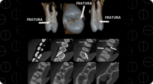 radiologia em foco