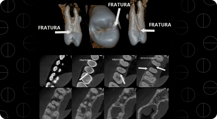 radiologia em foco